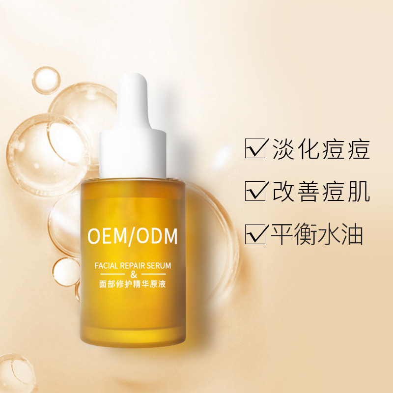 天津_祛痘精华原液OEM